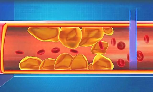 比糖和鹽更“可怕”的調(diào)味劑，我們可能每天都在吃！怪不得三高、肥胖等找上門